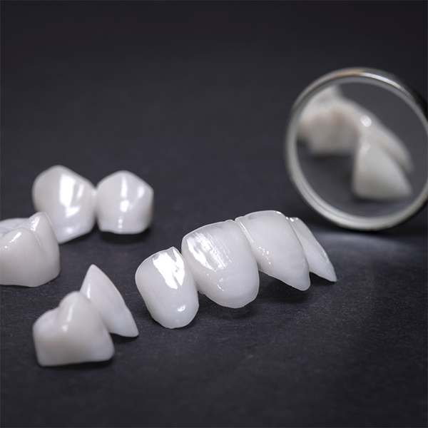 Several veneers next to a dental mirror