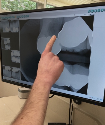 Dentist pointing to computer screen showing x rays of teeth