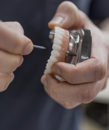 Dentist holding a model of an implant denture