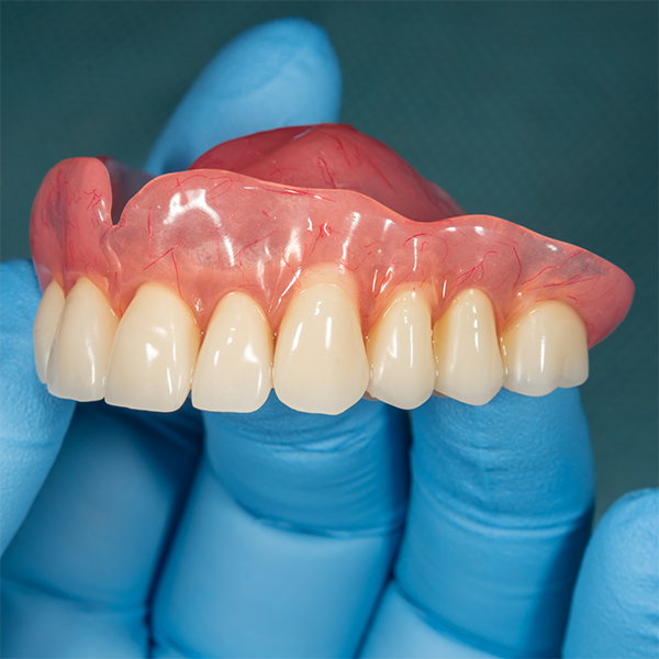 Dentist holding a full upper denture